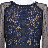 [50% OFF] Lace Dress 