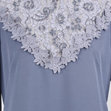 [50% OFF] Lace Dress